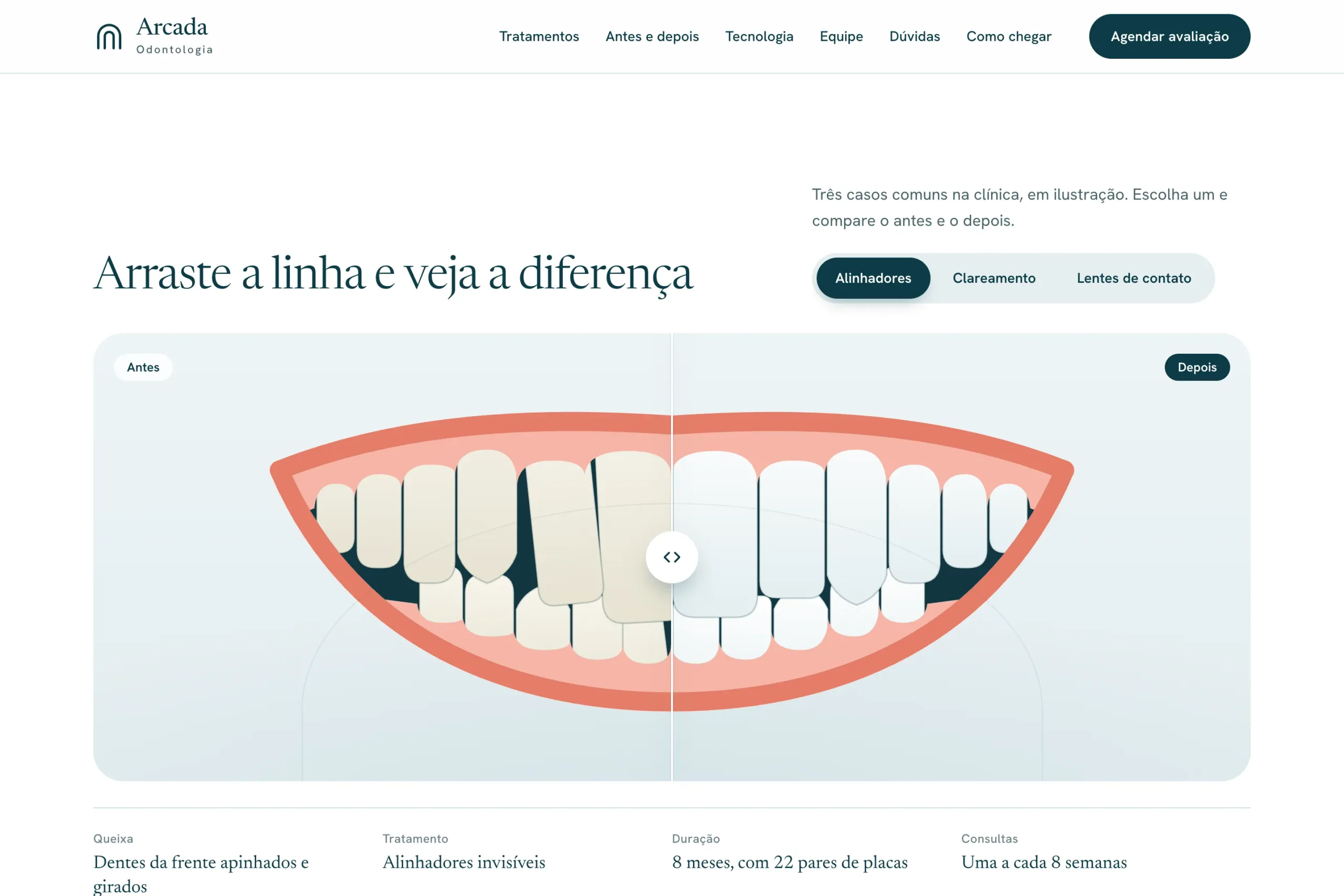 Illustrated smile split by a draggable before-and-after line